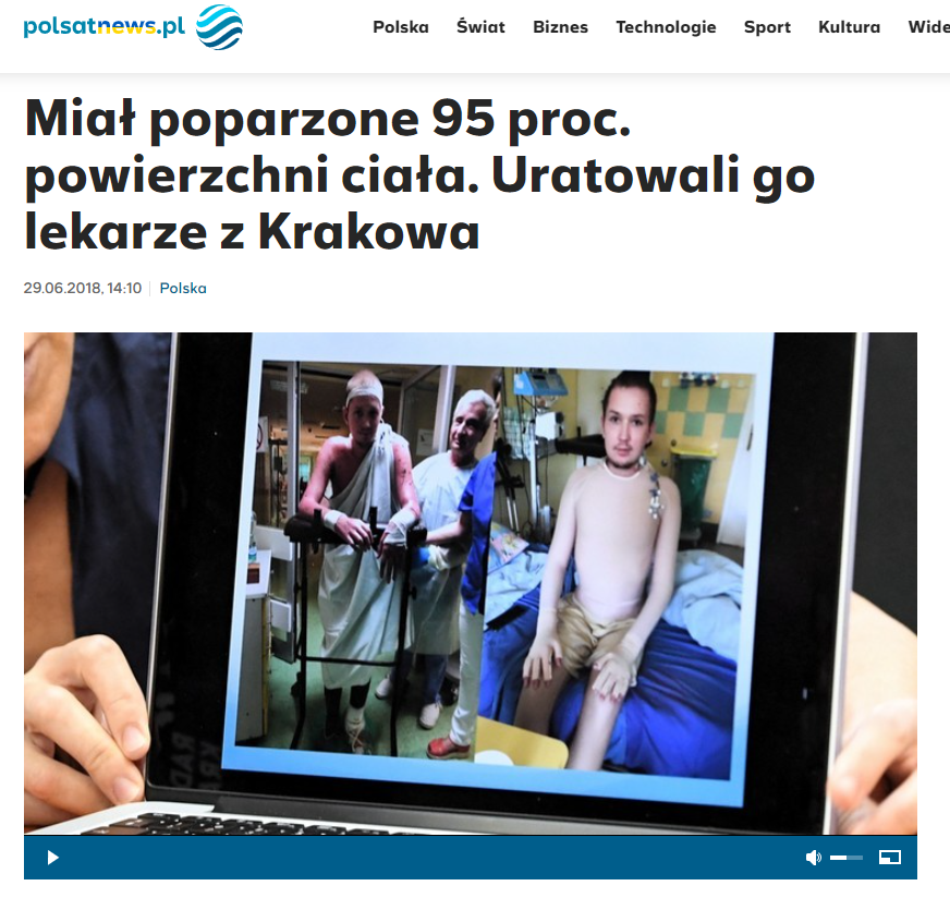 „Miał poparzone 95 proc. powierzchni ciała. Uratowali go lekarze z Krakowa” POLSAT News