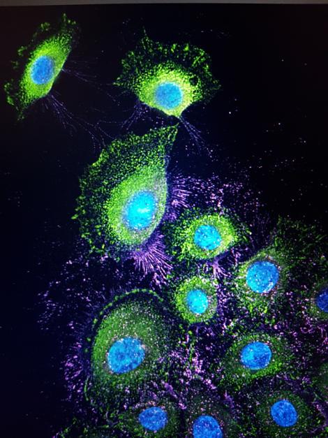 Zdjęcie nr 6 (10)
                                	                                   Keratynocyty ludzkie (komórki naskórka) w mikroskopie fluorescencyjnym
                                  